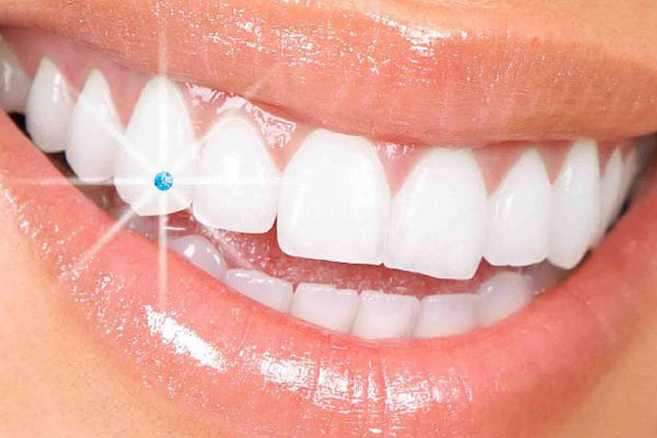 Make your teeth sparkle:-Tooth Jewellery | The Dental Arcade – Bl