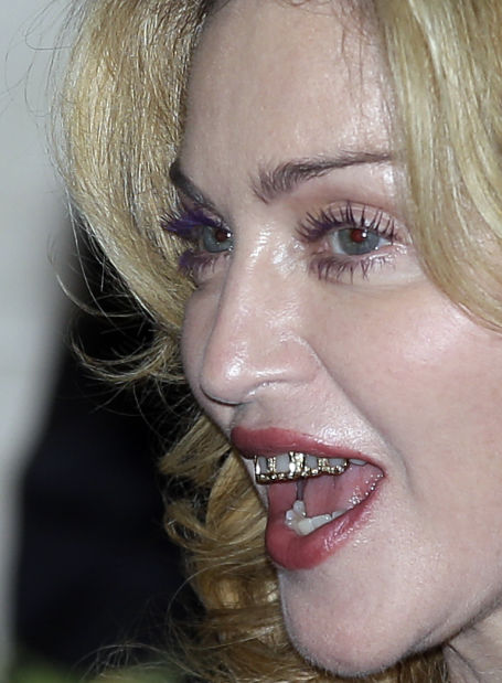 Photo: Madonna's tooth jewelry — flattering or not? | Latest .