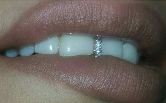A tooth gap filled with diamonds | Teeth jewelry, Diamond teeth .