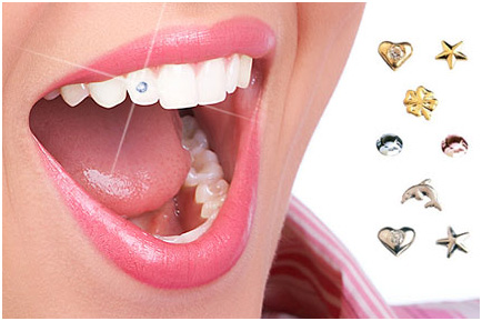 Dental Jewellery - Websi